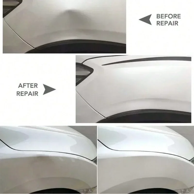 Set di 2 Sollevatori a Ventosa - Dent Repair Puller recensione e prezzo
